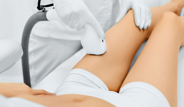 epilazione laser