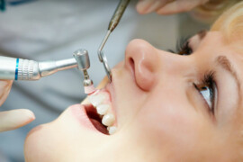 L’importanza dell’Igiene Orale Professionale: Salute Dentale e Estetica