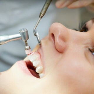 L’importanza dell’Igiene Orale Professionale: Salute Dentale e Estetica