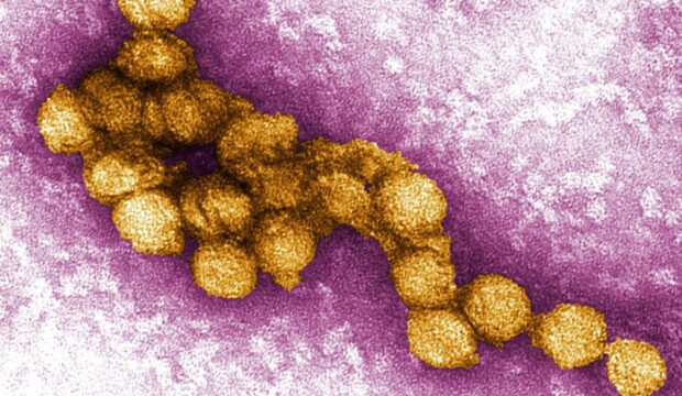 Micrograph of the west nile virus