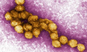 Il kit diagnostico per il West Nile: uno strumento concreto per non restare all’oscuro