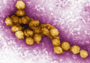 Il kit diagnostico per il West Nile: uno strumento concreto per non restare all’oscuro