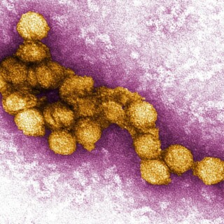 Il kit diagnostico per il West Nile: uno strumento concreto per non restare all’oscuro