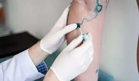 Salute vascolare: come prendersi cura delle nostre vene e arterie