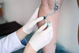 Salute vascolare: come prendersi cura delle nostre vene e arterie